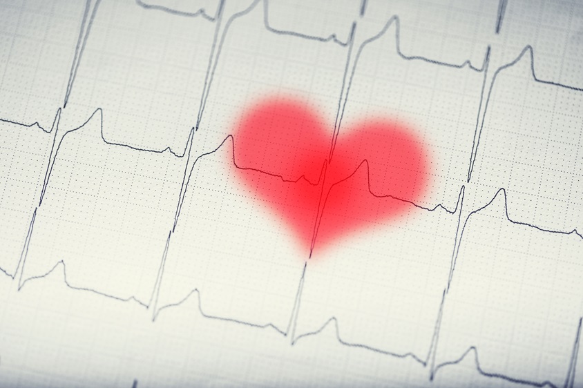 Echographie cardiaque
